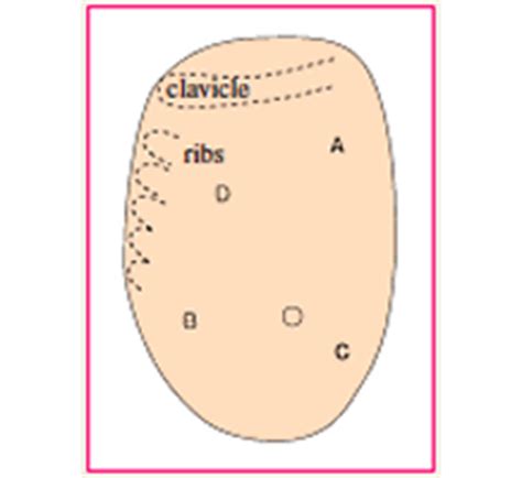 Visual Tactile Breast Examination Simulator