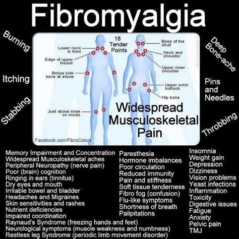 Pin On Fibromyalgia Information