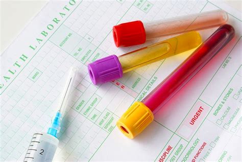 Urine And Blood Testing And How The Procedures Work