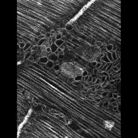 Cil36128 Damselfly Flight Muscle Cell Cil Dataset