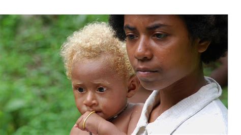 29 Best Photos Solomon Island Blonde Hair Minor Genetic Quirk Causes Melanesian Solomon People