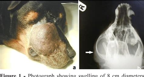 Figure 2 From Basal Cell Adenoma Of Zygomatic Salivary Gland In A Young