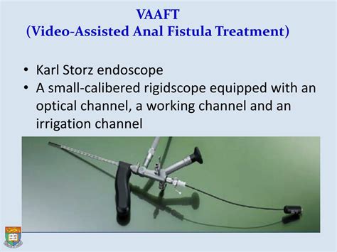 Ppt Recent Advances In Surgical Management Of Complex Cryptoglandular Anal Fistula Powerpoint