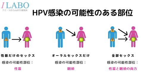 性器にHPV感染があると咽頭にも感染があるの 子宮頸がんSTD検査のアイラボ東京都 八王子市