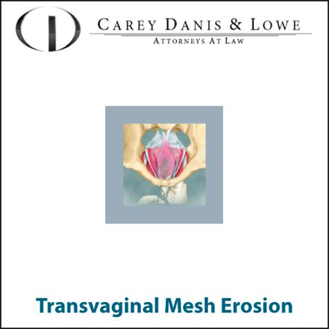 Transvaginal Mesh Erosion Mesh Side Effects