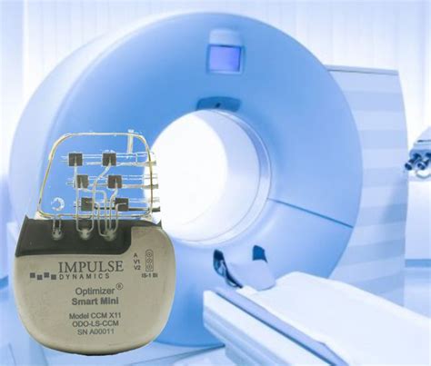 Impulse Dynamics Receives Full Body Mri Conditional Approval For