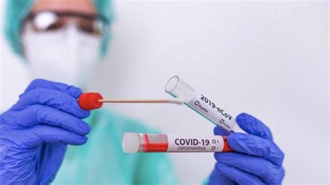 Infectólogo recomienda nuevas pruebas de antígeno para detectar COVID