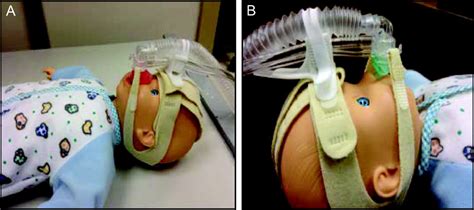 Comparison Of Interfaces For The Delivery Of Noninvasive Respiratory