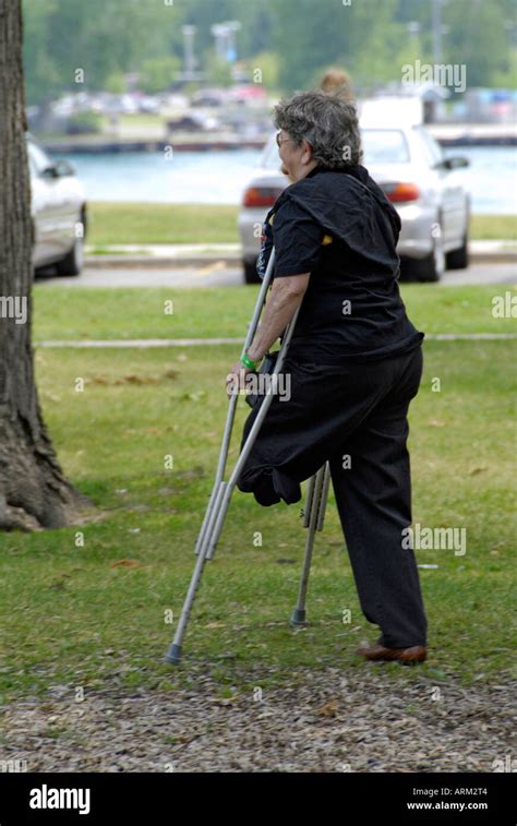 Senior Female With Amputated Leg Walks With The Aid Of Crutches Stock
