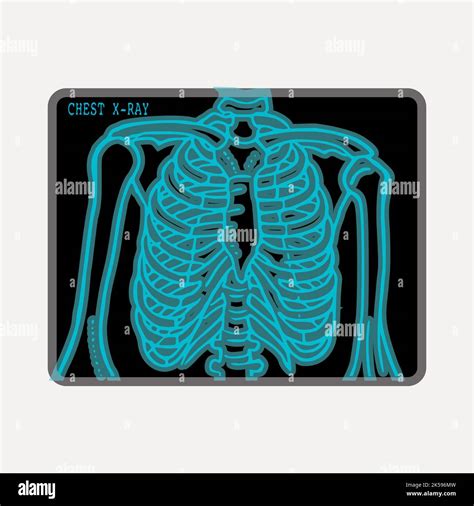 Chest X Ray Clipart Medical Illustration Vector Stock Vector Image