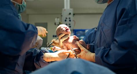 c section and normal delivery these are the differences cloudnine blog