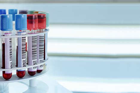 Elle est impliquée dans la fonction éjaculatoire, et peut être touchée par différentes maladies, particulièrement après 40 ans. Tout sur l'APS - Cancer de la prostate : PROCURE