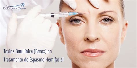 Toxina Botulínica Botox No Tratamento Do Espasmo Hemifacial