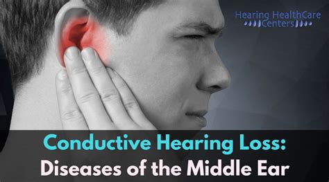 Conductive Hearing Loss Diseases Of The Middle Ear