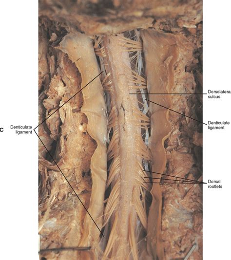 General Anatomy Of The Spinal Cord Basicmedical Key
