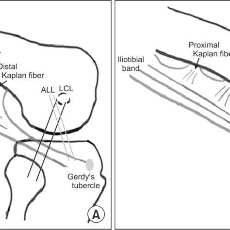 Anatomical Configuration Of The Anterolateral Ligament All A