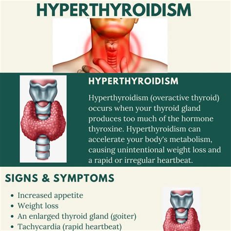 Hyperthyroidism Causes Symptoms And Herbal Treatment Pdf