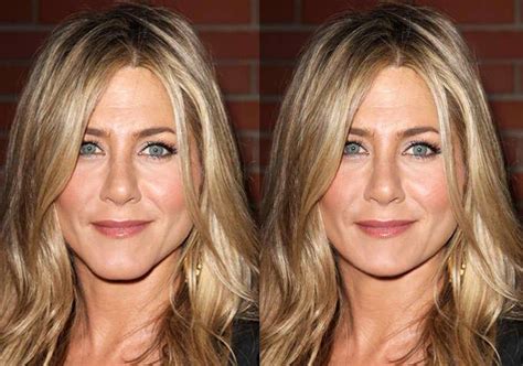 Jennifer Aniston Before And After Chin Surgery