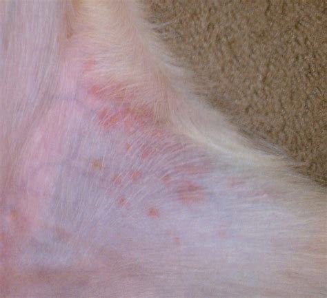 Albums 98 Images Photos Of Rashes On Legs Sharp