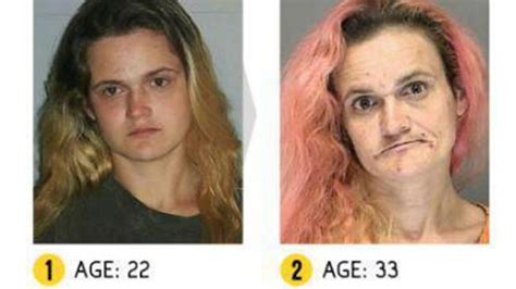Drug Addiction Before And After Photos Show Shocking Reality Of Addicts News Com Au