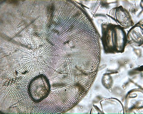 Diatoms Under Microscope 400x