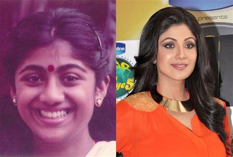 bollywood stars before and after cosmetic surgery desiblitz