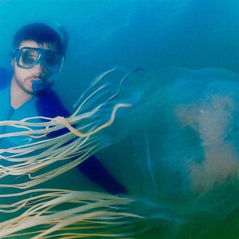 Vinegar Makes Box Jellyfish Stings Worse Research Jellyfish Sting