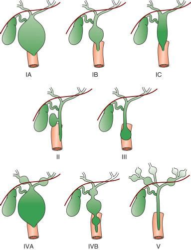 Congenital Hepatobiliary Anomalies Clinical Tree