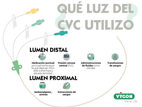 Catéteres Multilumen ¿qué Luz Utilizar Campus Vygon