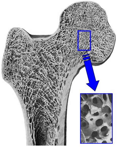 Materials Free Full Text Bone Substitute Fabrication Based On