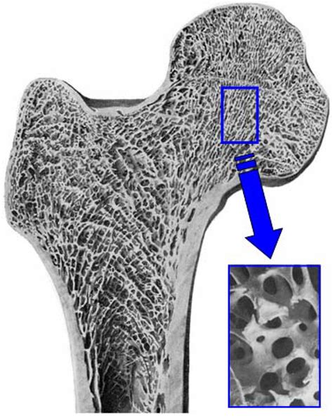 Materials Free Full Text Bone Substitute Fabrication