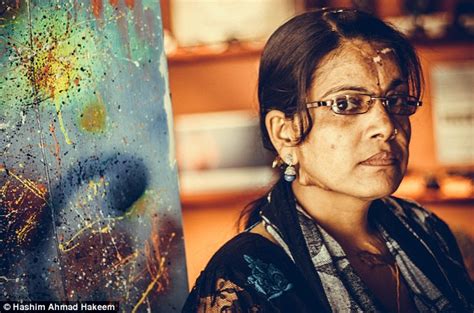 The Courageous Indian Women Scarred For Life From Acid Attacks Daily Mail Online