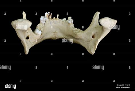 Lower Jaw Bone Anatomy