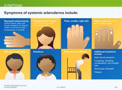 Sclerodermasymptoms