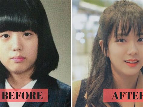 Lisa Blackpink Plastic Surgery Did Lisa Of Blackpink Get Plastic