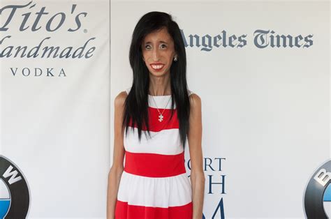 Four Reasons We Look Up To Lizzie Velasquez Toast Life