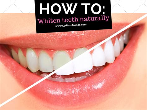 Home Remedies Teeth Whitening Hydrogen Peroxide Teeth Whitening Kits And Gels