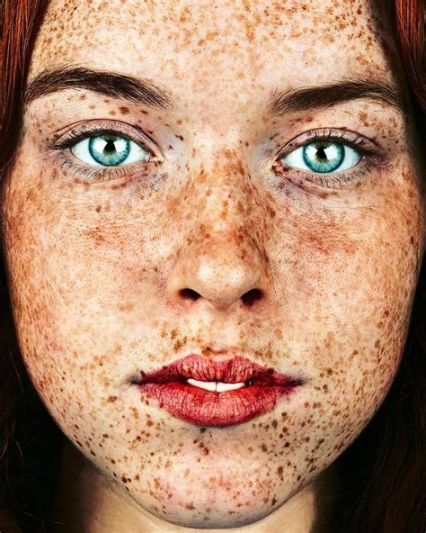 The Beauty Of The Freckles By The Photographer Brock Elbank Freckles