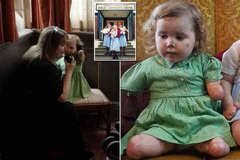 brave girl 4 who lost all her limbs to meningitis shows how she refuses to beaten by disease