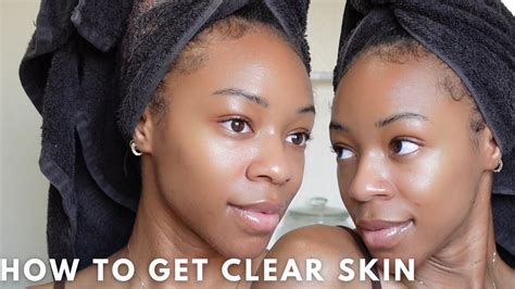 How To Get Smooth Clear Skin Fast And Easy Youtube