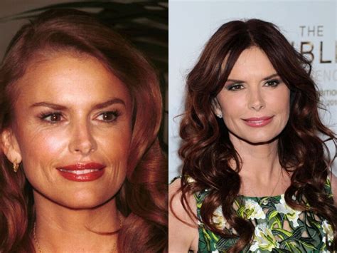 Roma Downey Plastic Surgery With Before And After Photos