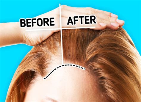 Causes Of Hair Loss And 7 Ways To Tell If Youre Losing Too Much Of It