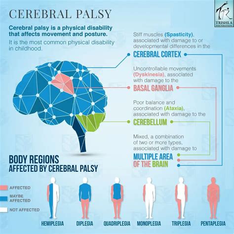 Spastic Cerebral Palsy Causes Symptoms And Management