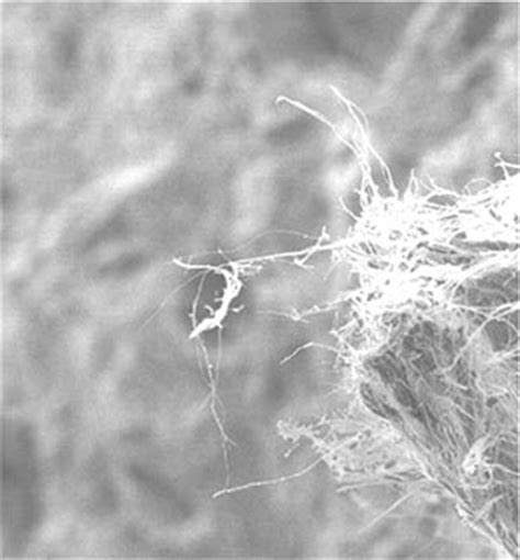 Claims for mesothelioma after death can be brought forward by the executors of the deceased's estate; Mesothelioma & Asbestos | California Mesothelioma Asbestos ...