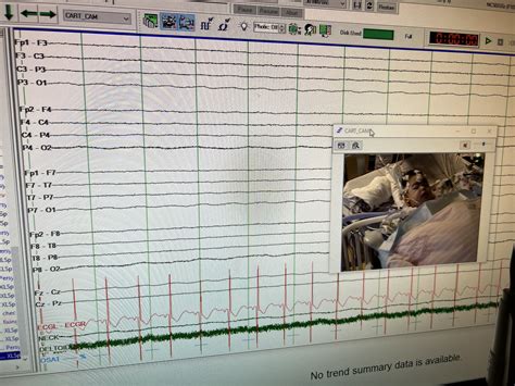 Status Epilepticus — Love For Baby Sloan