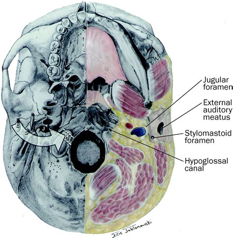 The Changing Face Of Malignant Necrotising External Otitis Clinical