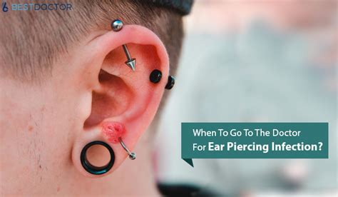 When To Go To The Doctor For Ear Piercing Infection And What To Expect