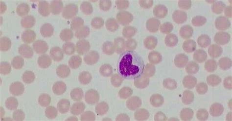 Blood Wrights Stain Monocyte Animal Tissues Pinterest