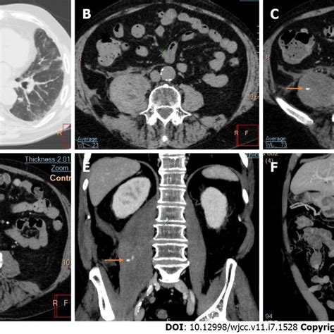 Axial Computed Tomography Followed By Coronal And Sagittal Download Scientific Diagram