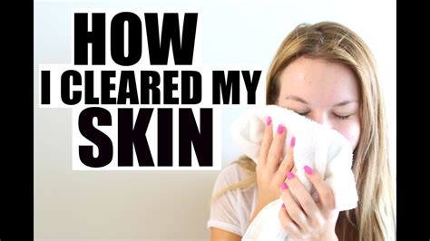 How I Cleared My Acne Youtube